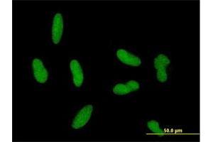 Immunofluorescence of purified MaxPab antibody to ZNF461 on HepG2 cell.