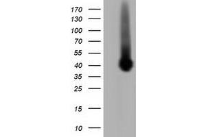 Western Blotting (WB) image for anti-Pleckstrin (PLEK) antibody (ABIN1500271) (Pleckstrin anticorps)