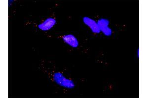 Proximity Ligation Analysis of protein-protein interactions between MAPKAPK5 and EIF4EBP1.