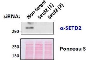SETD2 Antibody (0. (SETD2 anticorps  (Internal Region))