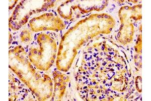 IHC image of ABIN7157026 diluted at 1:100 and staining in paraffin-embedded human kidney tissue performed on a Leica BondTM system. (IQCB1 anticorps  (AA 445-598))