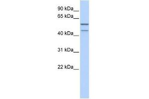 Western Blot showing ZNF474 antibody used at a concentration of 1-2 ug/ml to detect its target protein. (ZNF474 anticorps  (N-Term))