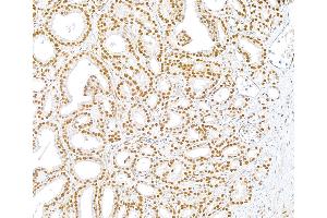 Immunohistochemistry (IHC) image for anti-U2 Small Nuclear RNA Auxiliary Factor 1 (U2AF1) (AA 140-190) antibody (ABIN7453889) (U2AF1 anticorps  (AA 140-190))
