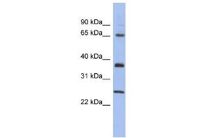 WB Suggested Anti-HORMAD2 Antibody Titration: 0. (HORMAD2 anticorps  (Middle Region))