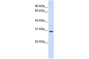 WB Suggested Anti-SLC25A20 Antibody Titration:  0. (SLC25A20 anticorps  (C-Term))