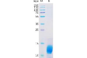 Mucin 1 (MUC1) (AA 1036-1156) protein (His tag)