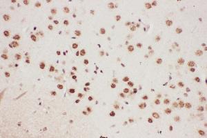 Anti-ALOX5 Picoband antibody,  IHC(P): Mouse Brain Tissue (ALOX5 anticorps  (AA 120-483))
