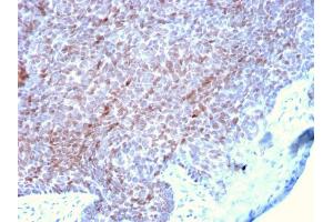 Formalin-fixed, paraffin-embedded human Skin stained with p73 Mouse Monoclonal Antibody (P73/2531). (Tumor Protein p73 anticorps)