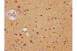 IHC image of ABIN7158941 diluted at 1:400 and staining in paraffin-embedded human brain tissue performed on a Leica BondTM system.