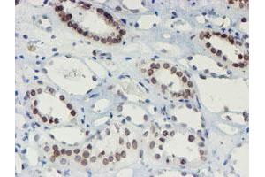 Image no. 6 for anti-SUMO1/sentrin/SMT3 Specific Peptidase 2 (SENP2) (AA 139-523) antibody (ABIN1490926) (SENP2 anticorps  (AA 139-523))