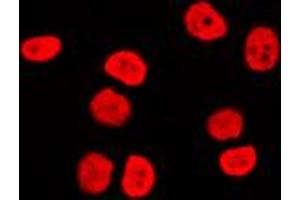 Immunofluorescent analysis of BAF170 staining in Raji cells. (SMARCC2 anticorps  (Center))