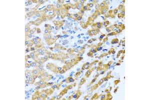 Immunohistochemistry of paraffin-embedded human liver using PROK2 antibody at dilution of 1:100 (40x lens). (PROK2 anticorps)