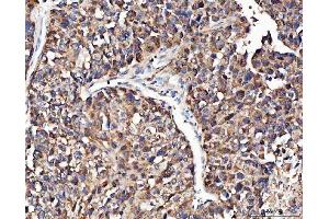 IHC analysis of Angiogenin/ANG using anti-Angiogenin/ANG antibody (ABIN4886457). (ANG anticorps  (AA 25-147))