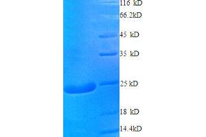 Cysteine and Glycine-Rich Protein 2 (CSRP2) (AA 2-193), (full length) protein (His tag)