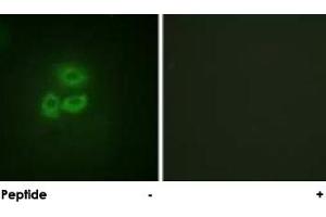 Immunofluorescence analysis of A-549 cells, using PRKD1 polyclonal antibody . (PKC mu anticorps  (Ser205))