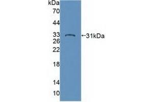 Detection of Recombinant PTPN22, Human using Polyclonal Antibody to Protein Tyrosine Phosphatase, Non Receptor Type 22 (PTPN22)
