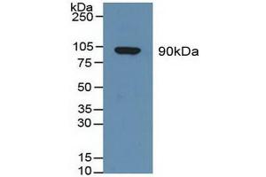 Western blot analysis of Human Serum. (Gelsolin anticorps  (AA 674-782))