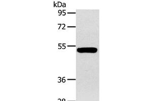 Western Blot analysis of Human fetal muscle tissue using GJA9 Polyclonal Antibody at dilution of 1:400 (GJA9 anticorps)