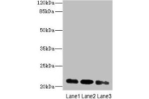 Western blot All lanes: MRPL11 antibody at 16 μg/mL Lane 1: HepG2 whole cell lysate Lane 2: Hela whole cell lysate Lane 3: A549 whole cell lysate Secondary Goat polyclonal to rabbit IgG at 1/10000 dilution Predicted band size: 21, 19, 20 kDa Observed band size: 21 kDa (MRPL11 anticorps  (AA 1-191))