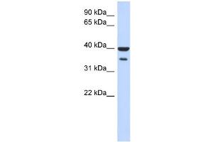 WB Suggested Anti-ZNF785 Antibody Titration:  0. (ZNF785 anticorps  (N-Term))