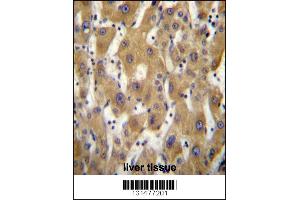 PAGE5 Antibody immunohistochemistry analysis in formalin fixed and paraffin embedded human liver tissue followed by peroxidase conjugation of the secondary antibody and DAB staining. (PAGE5 anticorps  (C-Term))