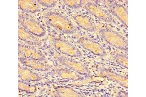 Immunohistochemistry of paraffin-embedded human small intestine tissue using ABIN7146019 at dilution of 1:100 (CCL8 anticorps  (AA 24-99))