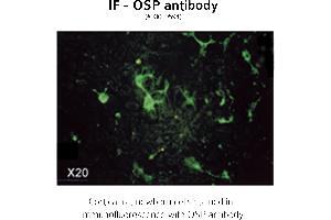 Image no. 3 for anti-Claudin 11 (CLDN11) (C-Term) antibody (ABIN346949) (Claudin 11 anticorps  (C-Term))