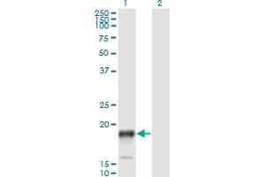 Western Blotting (WB) image for anti-Prostate Stem Cell Antigen (PSCA) (AA 23-96) antibody (ABIN961134) (PSCA anticorps  (AA 23-96))