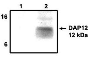 Immunoprecipitation using DAP12  antibody on MHC class I (1) and  NKp44 (2) positive cells. (TYROBP anticorps  (Cytoplasmic Domain))