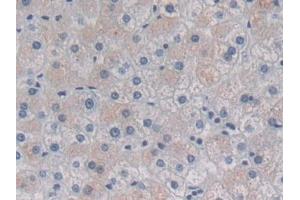 Detection of HSPb7 in Human Liver Tissue using Polyclonal Antibody to Heat Shock Protein Beta 7 (HSPb7)