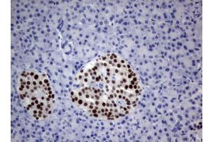 Image no. 2 for anti-Paired Box 5 (PAX5) antibody (ABIN1500036) (PAX5 anticorps)