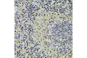Immunohistochemistry of paraffin-embedded mouse spleen using POT1 antibody (ABIN5970699) at dilution of 1/100 (40x lens). (POT1 anticorps)