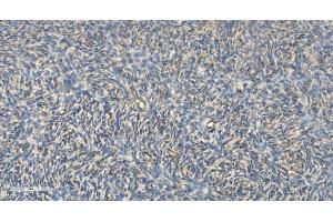 IHC analysis of FLCN using anti-FLCN antibody (ABIN7602491). (FLCN anticorps  (AA 8-551))