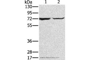 Western blot analysis of Mouse liver tissue and hepg2 cell, using SLC25A13 Polyclonal Antibody at dilution of 1:450 (slc25a13 anticorps)