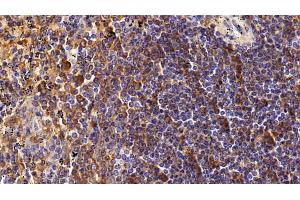 Detection of CD4 in Human Spleen Tissue using Polyclonal Antibody to Cluster Of Differentiation 4 (CD4) (CD4 anticorps  (AA 26-396))