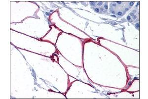 Human Adipocytes: Formalin-Fixed, Paraffin-Embedded (FFPE) (PLIN4 anticorps  (Internal Region))