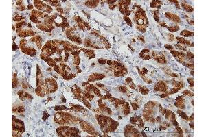 Immunoperoxidase of monoclonal antibody to CTH on formalin-fixed paraffin-embedded human pancreas.