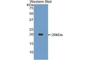 Western blot analysis of the recombinant protein.