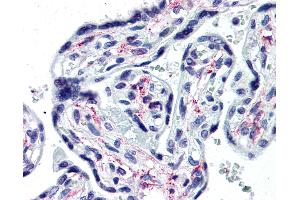 Anti-IL1R1 antibody IHC of human placenta. (IL1R1 anticorps  (Extracellular Domain))