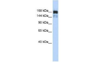 XRN1 antibody used at 1 ug/ml to detect target protein. (XRN1 anticorps  (Middle Region))