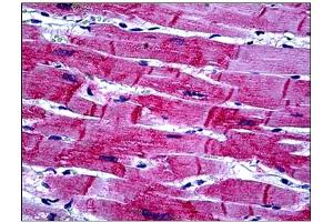 Immunohistochemistry (IHC) image for anti-Heat Shock 22kDa Protein 8 (HSPB8) antibody (ABIN781911)