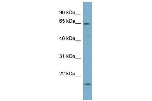 Plastin 3 antibody used at 1 ug/ml to detect target protein. (Plastin 3 anticorps)