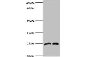 Western blot All lanes: Dickkopf-related protein 4 antibody at 8 μg/mL Lane 1: Jurkat whole cell lysate Lane 2: K562 whole cell lysate Secondary Goat polyclonal to rabbit IgG at 1/10000 dilution Predicted band size: 25 kDa Observed band size: 25 kDa (DKK4 anticorps  (AA 19-224))