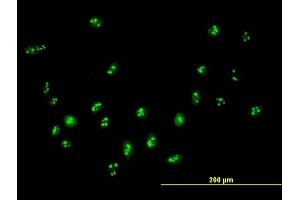 Immunofluorescence of purified MaxPab antibody to DDX18 on HeLa cell. (DDX18 anticorps  (AA 1-670))