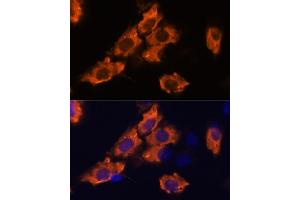 Immunofluorescence analysis of C6 cells using SEMA antibody (ABIN7270199) at dilution of 1:100.