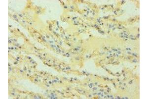 Immunohistochemistry of paraffin-embedded human lung tissue using ABIN7155546 at dilution of 1:100