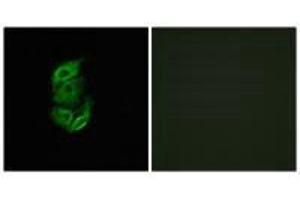 Immunofluorescence analysis of A549 cells, using STA13 antibody. (STARD13 anticorps  (N-Term))