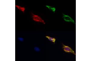 ABIN6262190 and ABIN6269019 staining HepG2 by IF/ICC. (HDAC7 anticorps  (C-Term))
