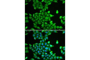Immunofluorescence analysis of MCF-7 cell using PSMA6 antibody. (PSMA6 anticorps  (AA 1-246))