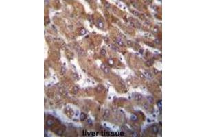 Immunohistochemistry (IHC) image for anti-Harakiri, BCL2 Interacting Protein (Contains Only BH3 Domain) (HRK) (BH3 Domain) antibody (ABIN2997154)